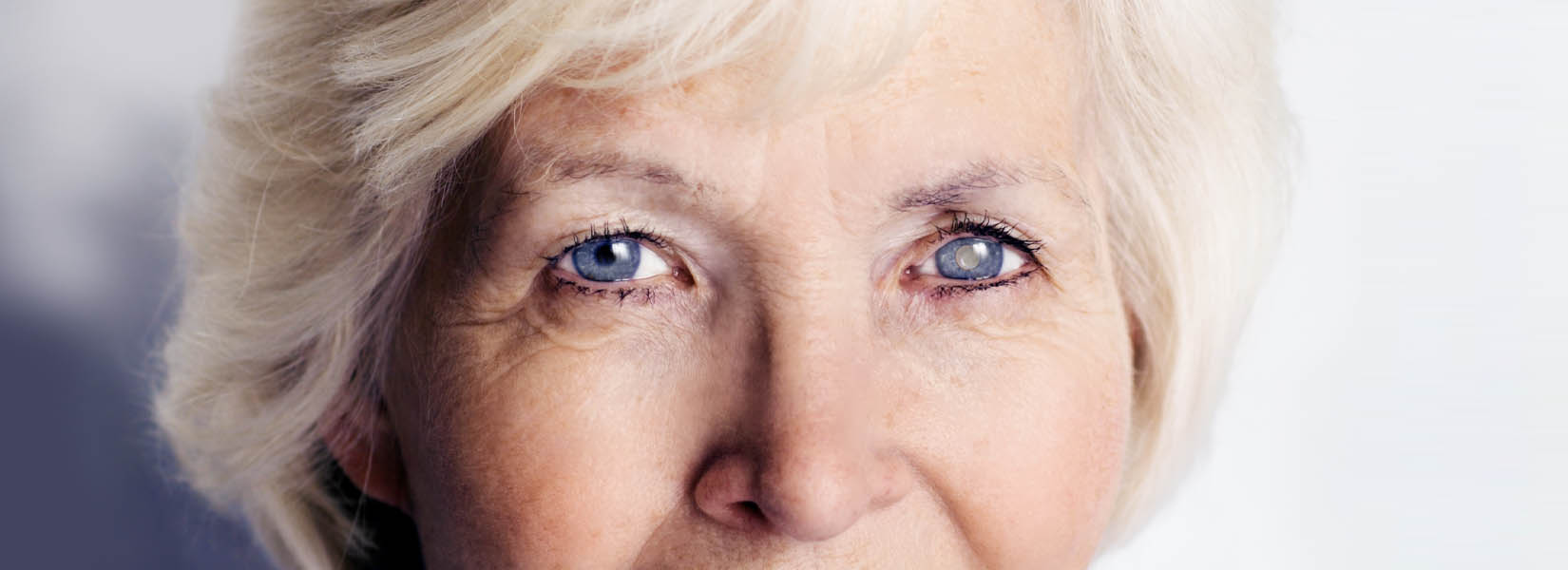 Cataract Surgery in Great Falls